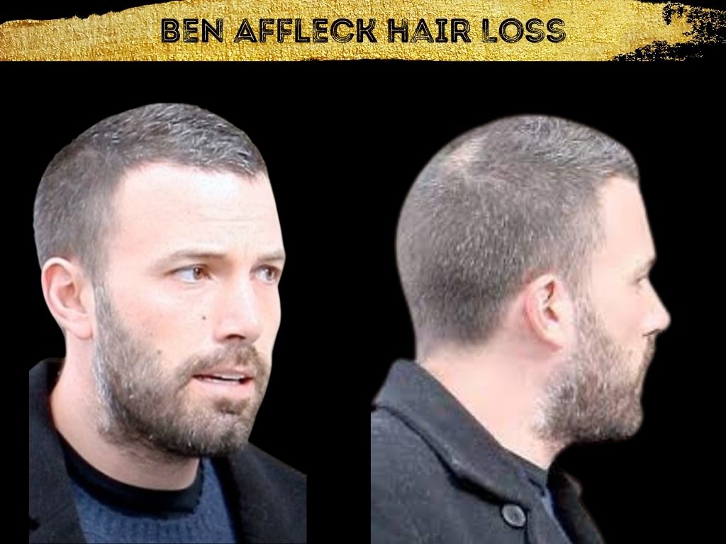 ben affleck wig